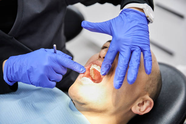 Best Emergency Treatment for Dental Infections or Abscesses in Bloomgton, IN